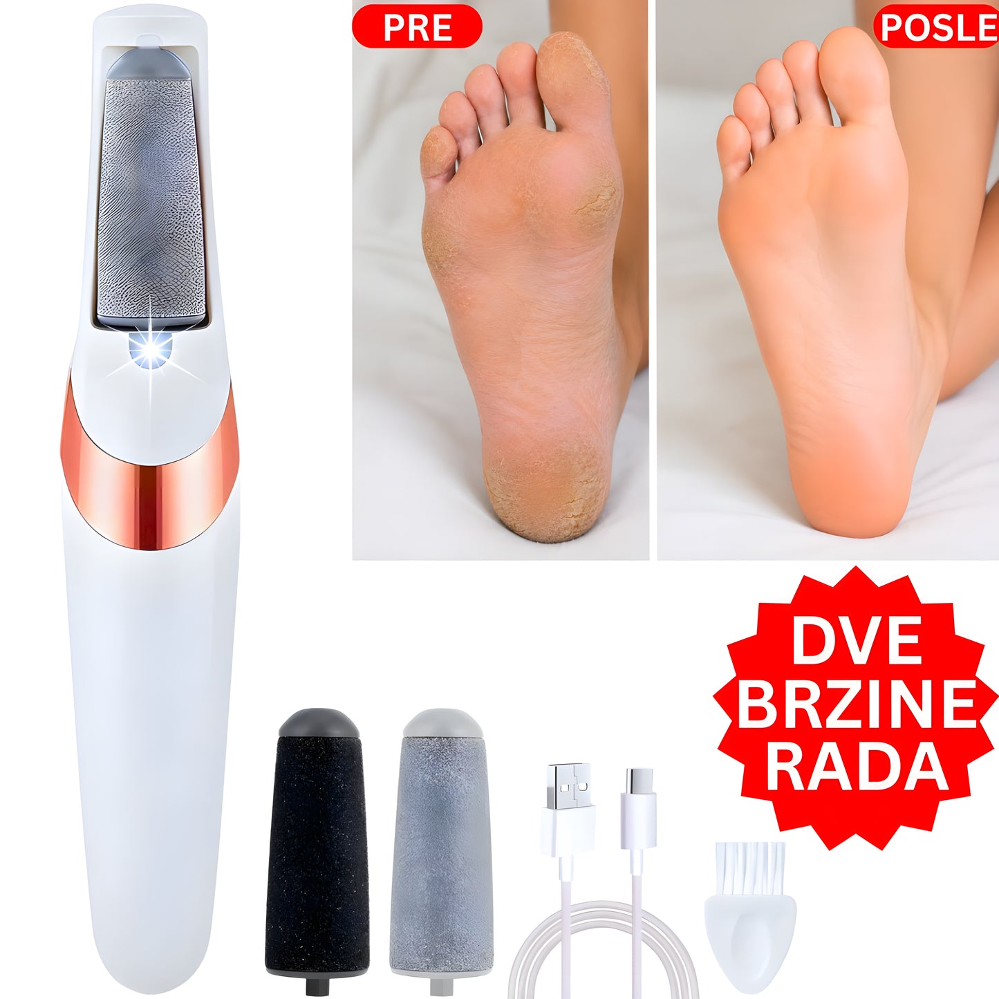 2U1 GLAMFeet - Električna Turpija za Uredne Pete